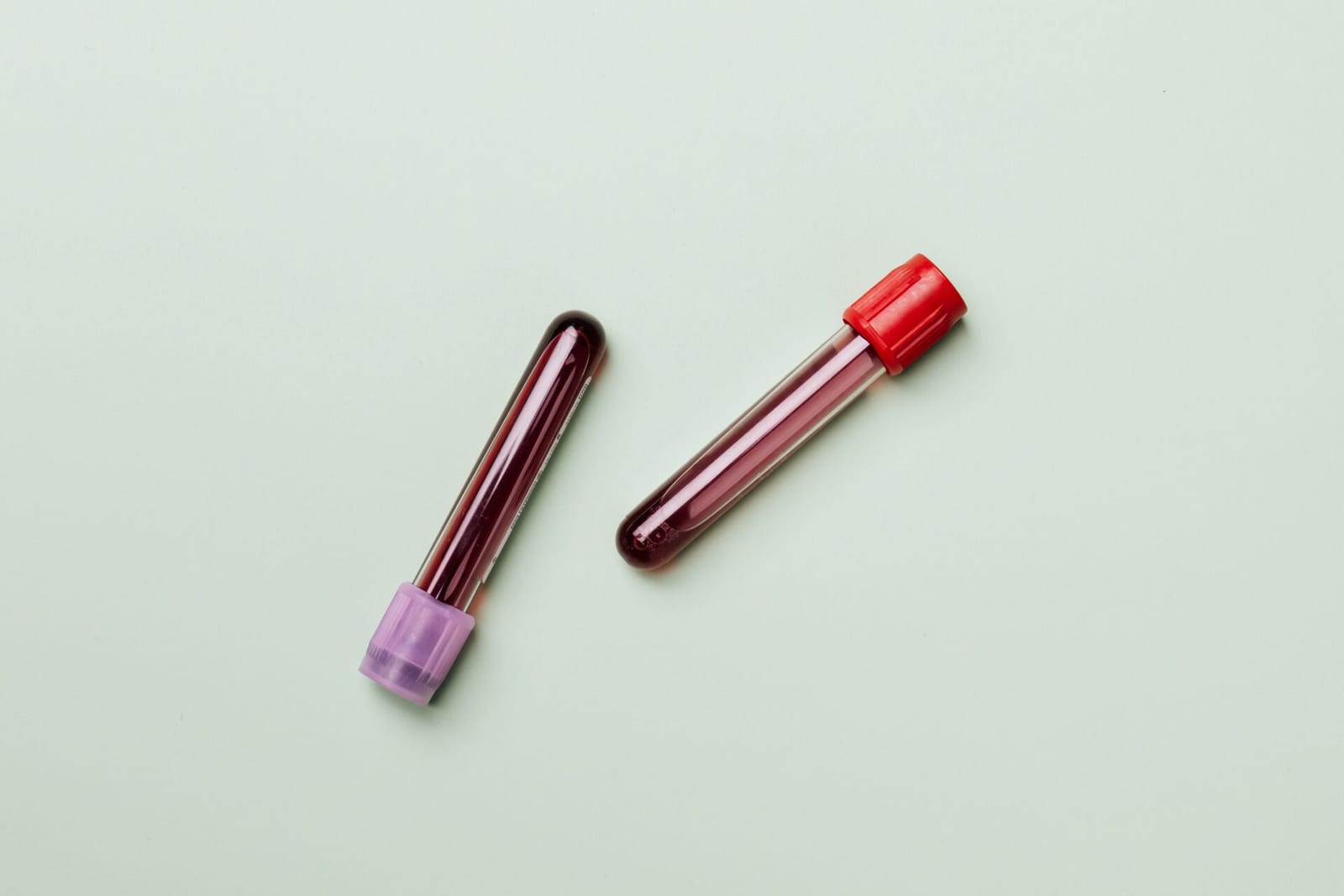 Blood tests