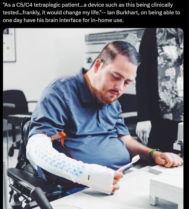Man can feel and control his arms